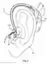 Fig. 06 - Non-invasive device and method for electrical stimulation of neural tissue