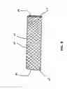 Fig. 07 - Prosthesis and method for deployment within a body lumen