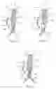 Fig. 03 - Methods and systems for aneurysm treatment using filling structures