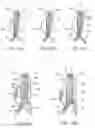 Fig. 05 - Methods and systems for aneurysm treatment using filling structures
