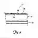 Fig. 04 - Embolic protection systems for bifurcated conduits