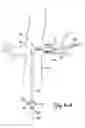 Fig. 07 - Embolic protection systems for bifurcated conduits
