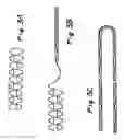 Fig. 04 - Methods And Apparatus For Treating Aneurysms And Other Vascular Defects