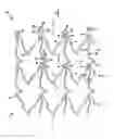 Fig. 02 - Stent