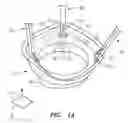 Fig. 02 - Connection Systems for Two Piece Prosthetic Heart Valve Assemblies and Methods for Using Them