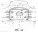Fig. 05 - Connection Systems for Two Piece Prosthetic Heart Valve Assemblies and Methods for Using Them