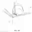 Fig. 11 - Connection Systems for Two Piece Prosthetic Heart Valve Assemblies and Methods for Using Them