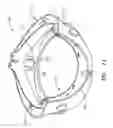 Fig. 16 - Connection Systems for Two Piece Prosthetic Heart Valve Assemblies and Methods for Using Them