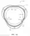 Fig. 17 - Connection Systems for Two Piece Prosthetic Heart Valve Assemblies and Methods for Using Them