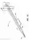 Fig. 04 - Apparatus and methods for loading of an IOL injector