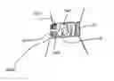 Fig. 01 - Methods and devices for intervertebral augmentation using injectable formulations and enclosures