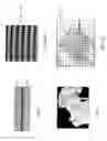 Fig. 02 - Methods and devices for intervertebral augmentation using injectable formulations and enclosures
