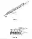 Fig. 03 - Methods and devices for intervertebral augmentation using injectable formulations and enclosures