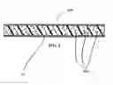Fig. 05 - Methods and devices for intervertebral augmentation using injectable formulations and enclosures