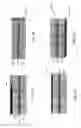 Fig. 07 - Methods and devices for intervertebral augmentation using injectable formulations and enclosures