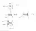 Fig. 20 - Methods and devices for intervertebral augmentation using injectable formulations and enclosures