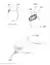 Fig. 29 - Methods and devices for intervertebral augmentation using injectable formulations and enclosures