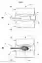 Fig. 04 - Rehydration and restoration of intervertebral discs with polyelectrolytes