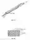 Fig. 03 - Devices for intervertebral augmentation and methods of controlling their delivery