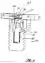Fig. 05 - Mounting system and method for enhancing implant fixation to bone