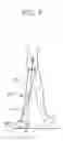 Fig. 03 - Implant device for osseointegration to endure weight