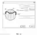 Fig. 13 - Follicular unit transplantation planner and methods of its use