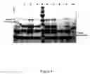 Fig. 05 - High-level expression of fusion polypeptides in plant seeds utilizing seed-storage proteins as fusion carriers