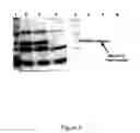 Fig. 06 - High-level expression of fusion polypeptides in plant seeds utilizing seed-storage proteins as fusion carriers