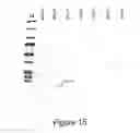 Fig. 16 - High-level expression of fusion polypeptides in plant seeds utilizing seed-storage proteins as fusion carriers
