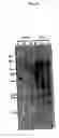 Fig. 11 - Nicotianamine synthase and gene encoding the same