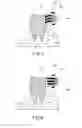 Fig. 08 - Electric toothbrush