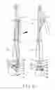 Fig. 05 - Mop with Foldaway Rod