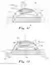 Fig. 05 - Cord tensioning apparatus and method of securing a cord using the same