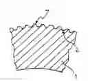 Fig. 01 - Process for producing a stent for angioplasty