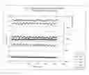 Fig. 03 - Extraction apparatus