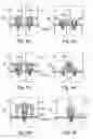 Fig. 07 - Measurement transducer of vibration-type