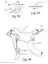 Fig. 16 - Bicycle shift operating device