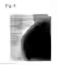 Fig. 04 - FINE COMPOSITE METAL PARTICLES AND THEIR PRODUCTION METHOD, MICRO-BODIES, AND MAGNETIC BEADS
