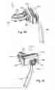 Fig. 25 - Elevation mechanism for table saws