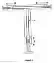 Fig. 03 - Method for the production and positioning of an intrauterine device which is adapted to the uterine cavity measurements
