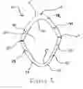 Fig. 02 - Easy breathing mouthguard
