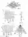 Fig. 04 - Hair pick