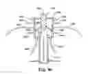 Fig. 10 - Treatment systems and methods