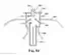 Fig. 11 - Treatment systems and methods