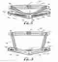 Fig. 06 - Zipperless expansion system