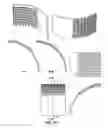 Fig. 14 - System and method of micromolded filtration microstructure and devices