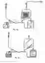 Fig. 07 - Blood component separation method and apparatus