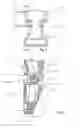 Fig. 03 - Coil spring hanger clip