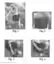 Fig. 02 - WAIST WORN POUCH