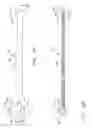 Fig. 06 - Surgical instrument with bending articulation controlled articulation pivot joint